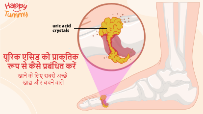 यूरिक एसिड को नैचुरली कैसे मैनेज करें: खाने और न करने के लिए सबसे अच्छे फूड्स